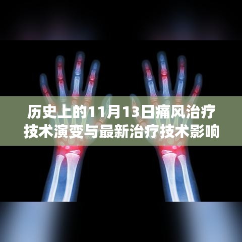 历史上的11月13日痛风治疗技术演变与最新治疗技术影响概览
