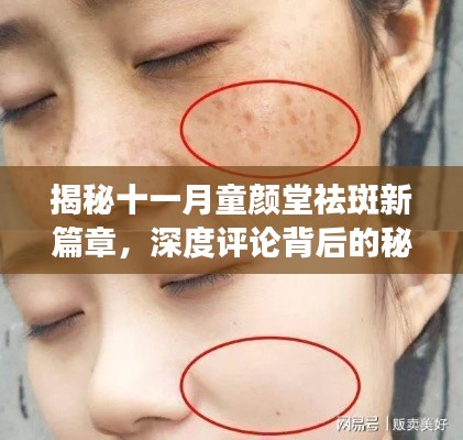 揭秘十一月童颜堂祛斑新篇章，深度评论背后的秘密与真实反馈