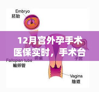 医保下的暖心瞬间，12月宫外孕手术之旅在手术台上的温情瞬间